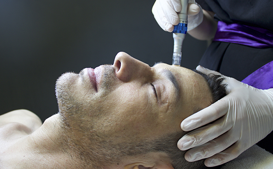 man having a surgical needling treatment