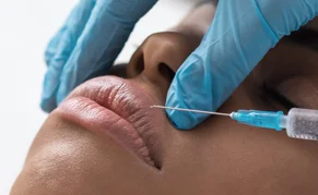 woman in a filler procedure