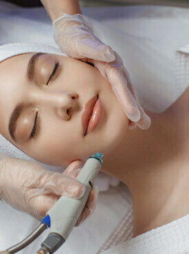 woman in a microneedling procedure